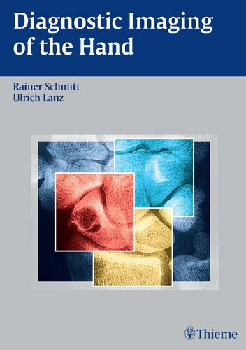 Diagnostic Imaging Of The Hand 1st Edition Rainer Schmitt Ulrich Lanz