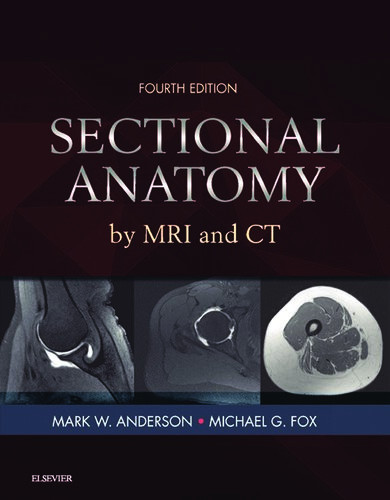 Sectional Anatomy By Mri And Ct 4th Edition Mark W Anderson Md