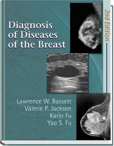 Diagnosis Of Diseases Of The Breast 2nd Edition Lawrence Wayne Bassett