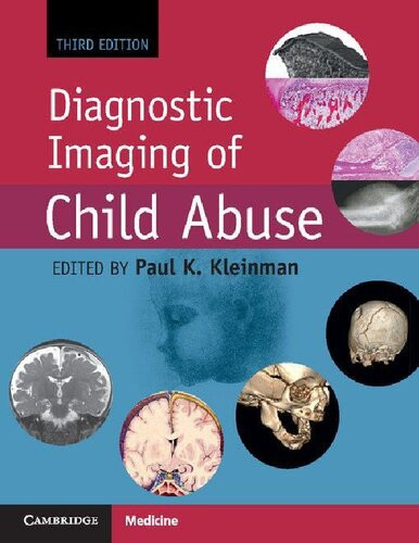 Diagnostic Imaging Of Child Abuse 3rd Edition Paul K Kleinman Editor