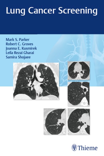 Lung Cancer Screening Parker Mark S