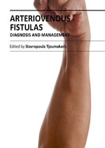 Arteriovenous Fistulas Diagnosis And Management Stavropoula Tjoumakaris Editor