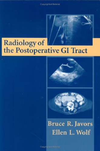Radiology Of The Postoperative Gi Tract Wolf Ellen L Javors