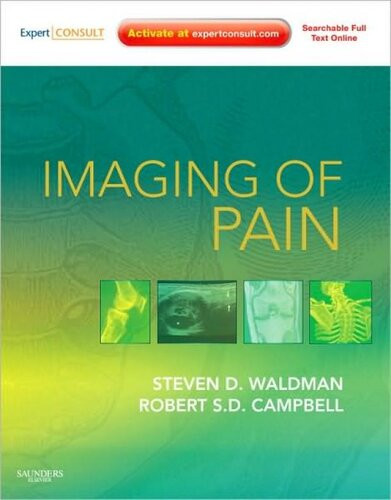 Imaging Of Pain Expert Consult 1st Edition Dr Steven D Waldman Md Jd