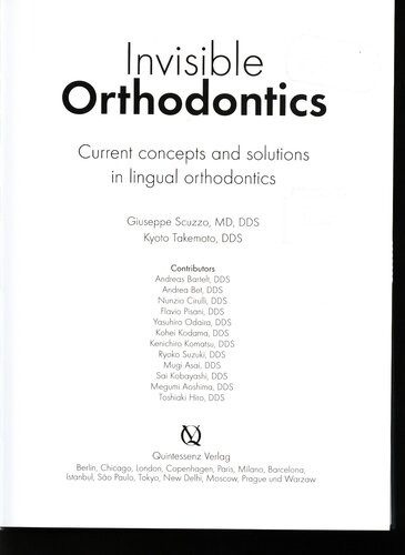 Invisible Orthodontics Current Concepts And Solutions In Lingual Orthodontics Giuseppe Scuzzo