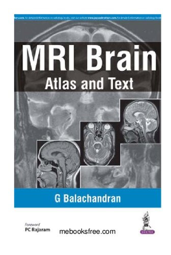Mri Brain Atlas And Text 1st Edition Md Balachandran G