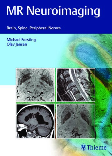 Mr Neuroimaging Brain Spine And Peripheral Nerves 1st Edition Michael Forsting Editor