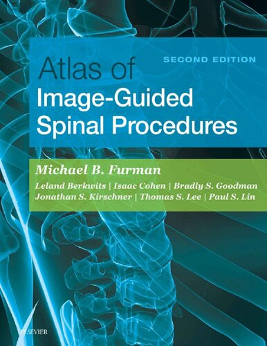 Atlas Of Imageguided Spinal Procedures 2nd Edition Michael Furman