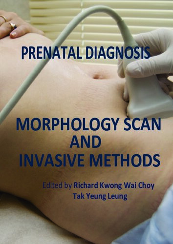 Prenatal Diagnosis Morphology Scan And Invasive Methods Richard Choy Editor