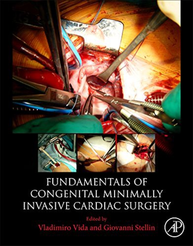 Fundamentals Of Congenital Minimally Invasive Cardiac Surgery Stellin
