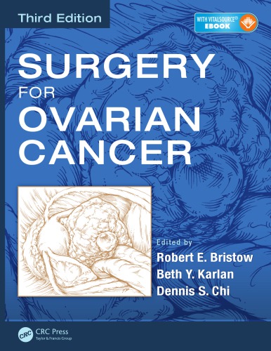 Surgery For Ovarian Cancer 3rd Ed Bristow Robert E Chi Dennis S Karlan