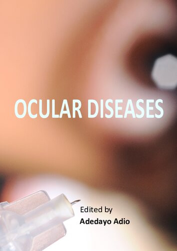 Ocular Diseases Adedayo Adio Editor
