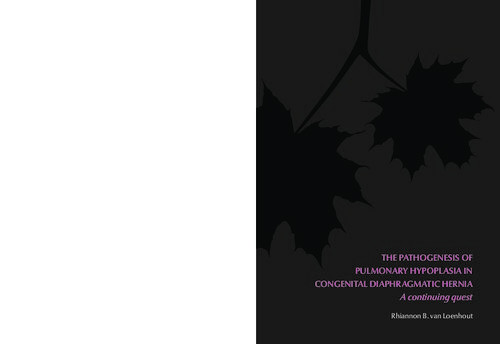 The Pathogenesis Of Pulmonary Hypoplasia In Congenital Diaphragmatic Hernia A Continuing Quest Rhiannon Loenhout