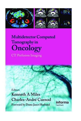 Multidetector Computed Tomography In Oncology Ct Perfusion Imaging 1st Edition Md Miles