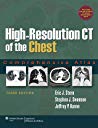 Highresolution Ct Of The Chest Comprehensive Atlas 3rd Edition Eric J Stern Stephen J Swensen Jeffrey P Kanne