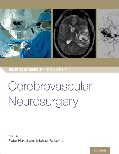Cerebrovascular Neurosurgery 1st Peter Nakaji Michael Levitt