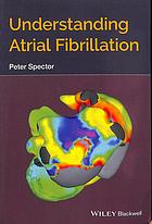 Understanding Atrial Fibrillation Spector Peter