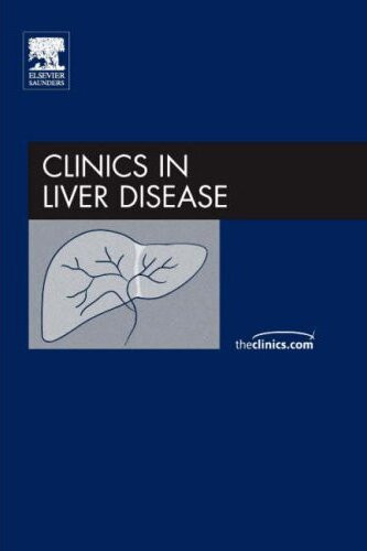 Coagulation And Hemostasis In Liver Disease Controversies And Advances Stephen H Caldwell Arun J Sanyal