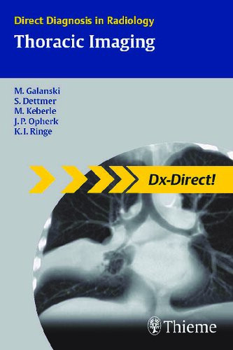 Direct Diagnosis In Radiology Thoracic Imaging Michael Galanski