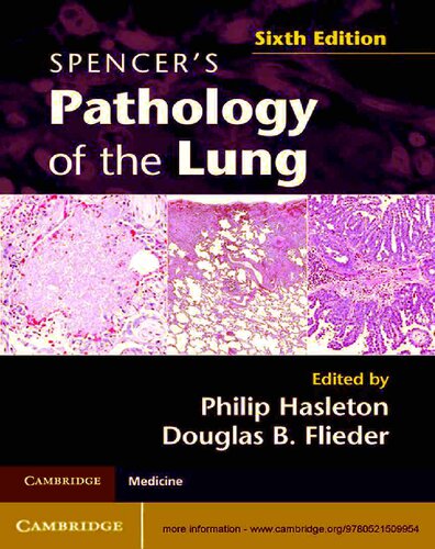 Spencers Pathology Of The Lung 6th Edition Philip Hasleton Douglas B Flieder