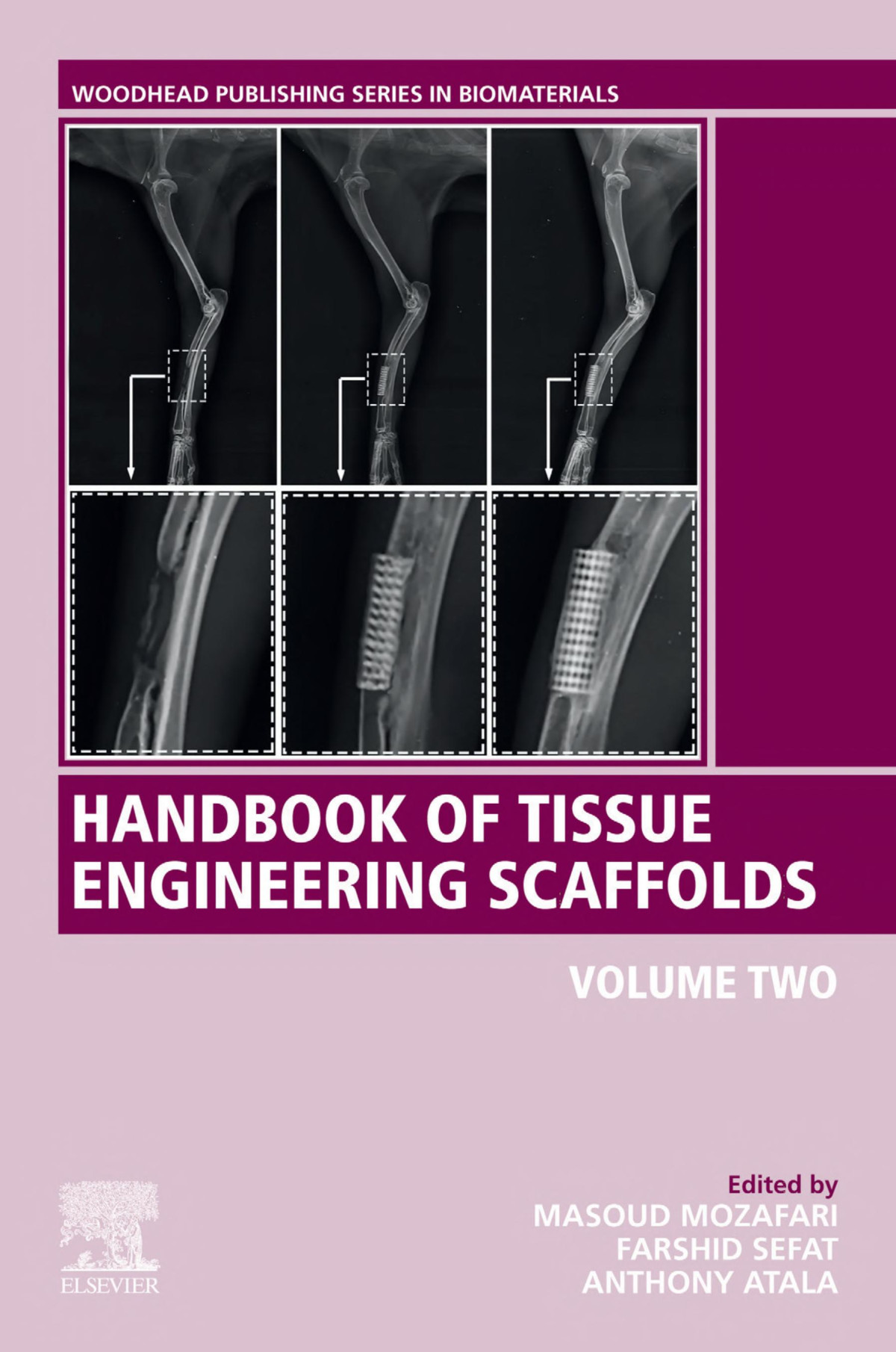 Handbook Of Tissue Engineering Scaffolds Masoud Mozafari Farshid Sefat Anthony Atala
