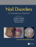 Nail Disorders A Comprehensive Approach Archana Singal Shekhar Neema Piyush Kumar