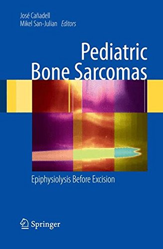 Pediatric Bone Sarcomas Epiphysiolysis Instead Of Excision 1st Edition Jos Caadell Editor