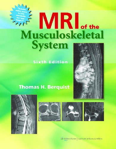 Berquist T Mri Of The Musculoskeletal System 6th Edition Thomas H Berquist