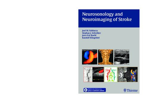 Neurosonology And Neuroimaging Of Stroke Book Dvd 1st Edition Jose M Valdueza
