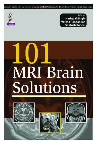 Singh H 101 Mri Brain Solutions 1st Edition Hariqbal Singh