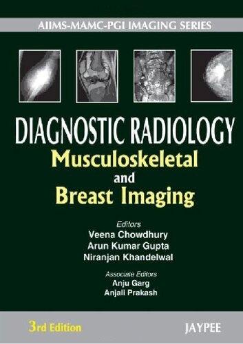 Diagnostic Radiology Musculoskeletal And Breast Imaging 3rd Revised Edition Veena Chowdhury