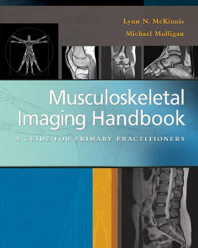 Musculoskeletal Imaging Handbook A Guide To Primary Practitioners 1st Edition Lynn N Mckinnis