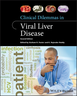 Clinical Dilemmas In Viral Liver Disease 2nd Edition K Rajender Reddy Graham Foster