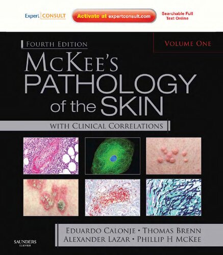 Mckees Pathology Of The Skin Volume 1 2 4th Edition Lazar Mckee Calonje