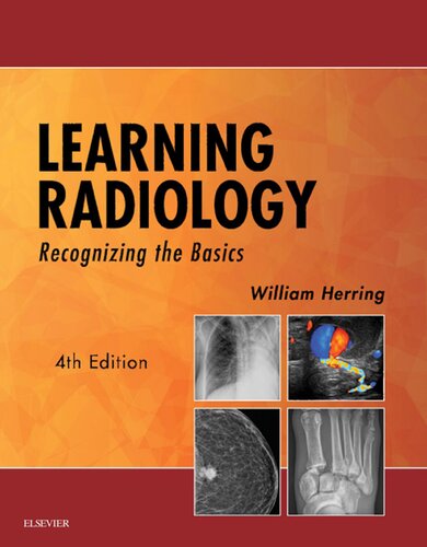 Learning Radiology Recognizing The Basics 4th Edition William Herring Md Facr