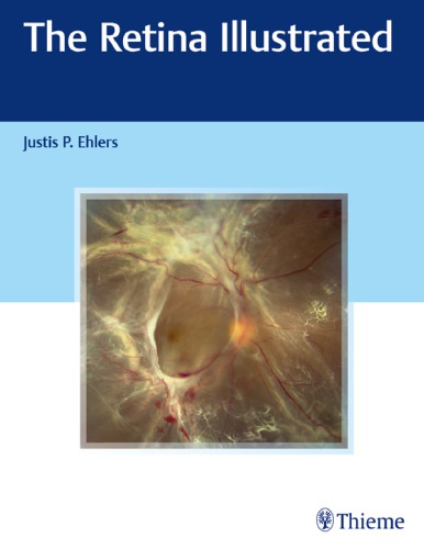 The Retina Illustrated 1st Justis P Ehlers
