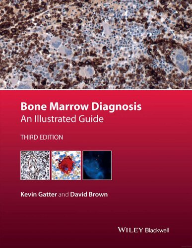 Bone Marrow Diagnosis An Illustrated Guide 3rd Edition Kevin Gatter