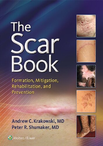 The Scar Book Formation Mitigation Rehabilitation And Prevention 1st Edition Andrew C Krakowski