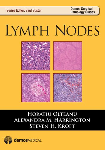 Lymph Nodes Horatiu Olteanu Steven H Kroft Alexandra M Harrington