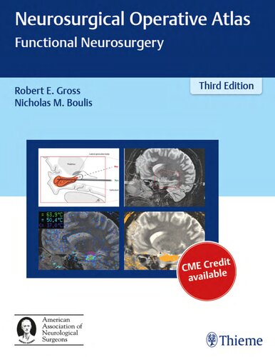 Neurosurgical Operative Atlas Functional Neurosurgery Third Edition Robert E Gross Editor Nicholas Boulis Editor