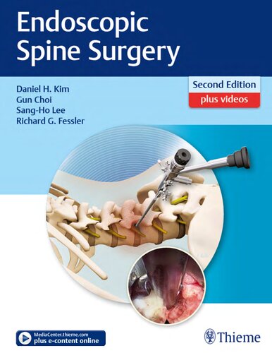 Endoscopic Spine Surgery 2 Daniel H Kim Gun Choi Sangho Lee