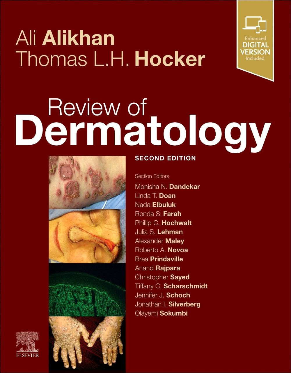 Review Of Dermatology 2nd Edition Ali Alikhan Thomas Hocker