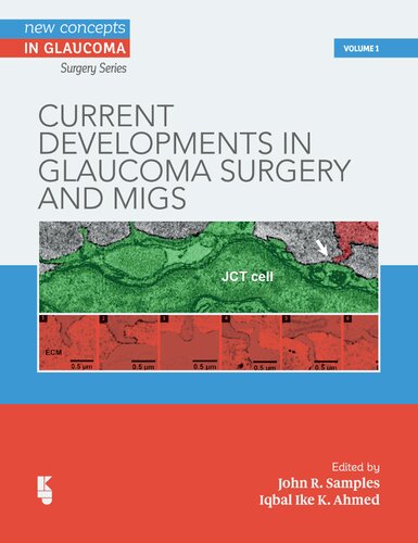 Current Developments In Glaucoma Surgery And Migs John R Samples Iqbal Editor