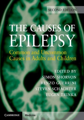 The Causes Of Epilepsy Common And Uncommon Causes In Adults And Children 2nd Edition Simon Shorvon Editor
