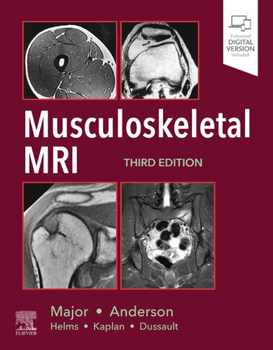 Musculoskeletal Mri 3rd Edition Nancy Major Mark W Anderson