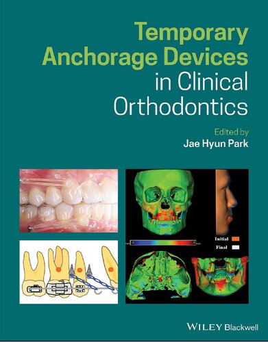 Temporary Anchorage Devices In Clinical Orthodontics Jae Hyun Park