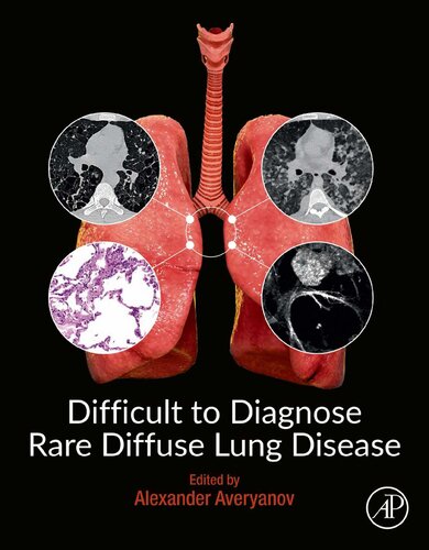 Difficult To Diagnose Rare Diffuse Lung Disease Alexander Averyanov Editor