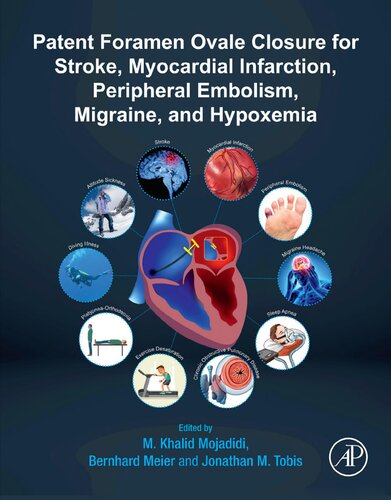 Patent Foramen Ovale Closure For Stroke Myocardial Infarction Peripheral Embolism Migraine And Hypoxemia 1st Edition M Khalid Mojadidi Editor