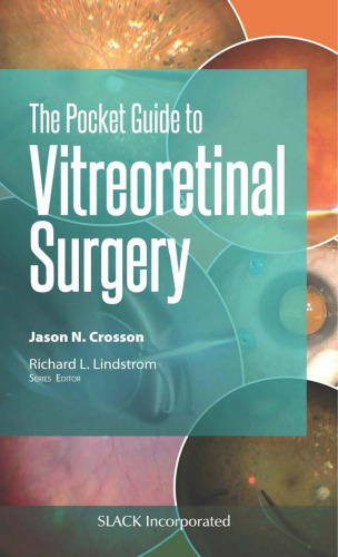 Pocket Guide To Vitreoretinal Surgery 1st Jason N Crosson