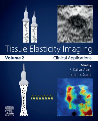 Tissue Elasticity Imaging Volume 2 Clinical Applications S Kaisar Alam Editor